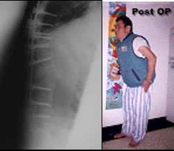 Spine