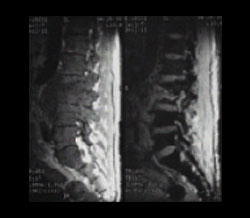 Spine