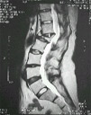 Spine