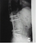 Spine